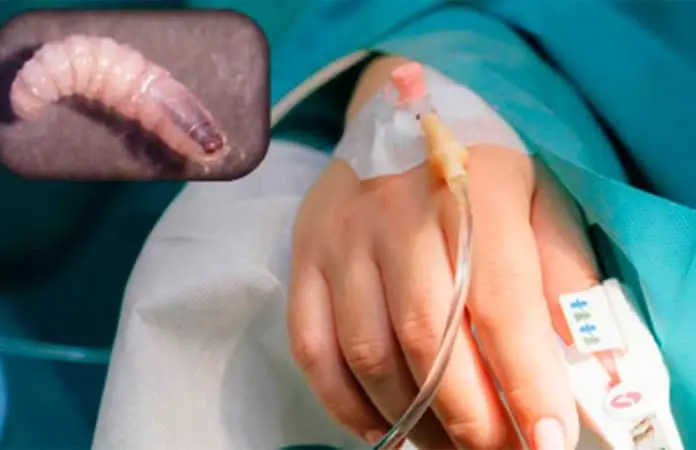 Infección por gusano&nbsp;barrenador