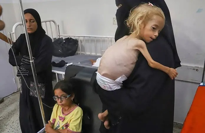 Niños en Gaza agonizan en&nbsp;silencio